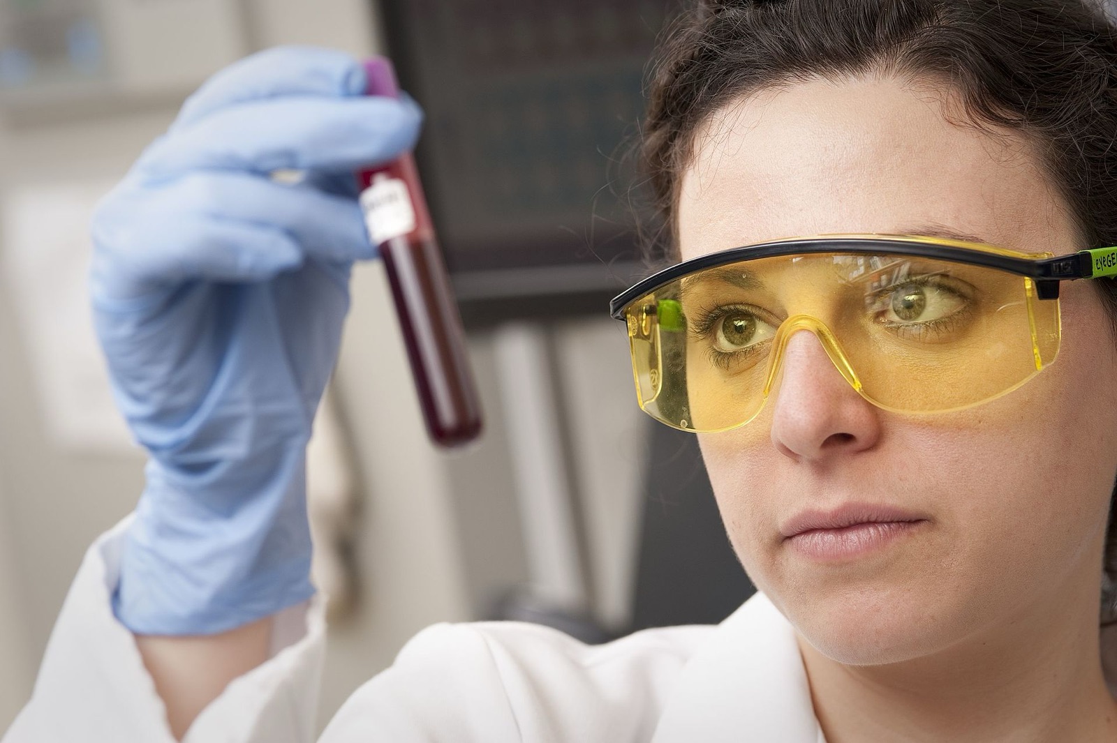 A lab technician examines a tube of blood